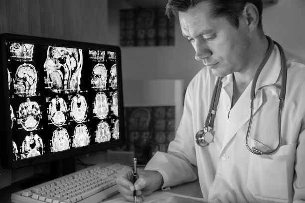 doctor examining brain scans 
