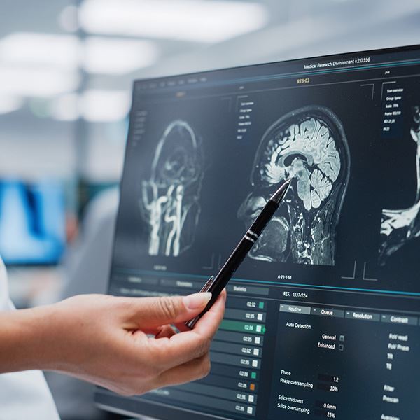 Brain Injuries